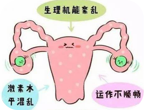卵巢早衰.png