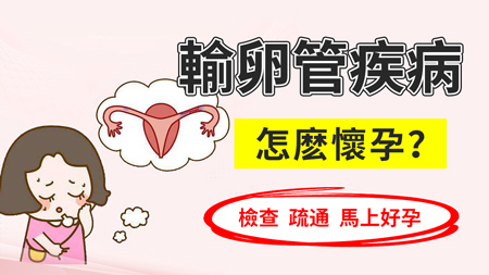 深圳市治療輸卵管堵塞哪家醫(yī)院專業(yè)